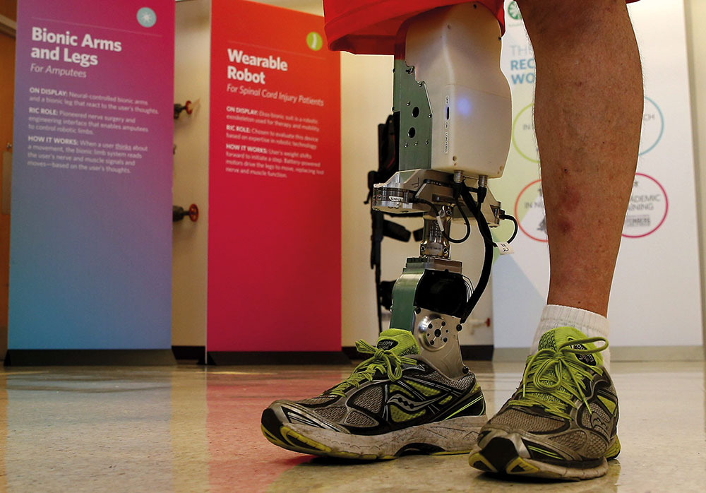 Bionic leg prototype implanted at the Rehabilitation Institute of Chicago. 