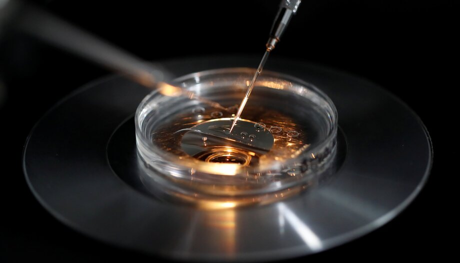 In-vitro-Fertilisation